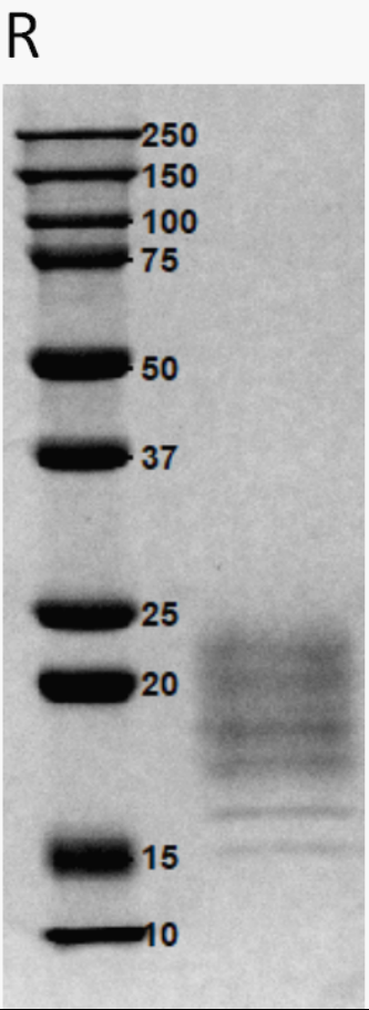 2、SDS-PAGE.jpg